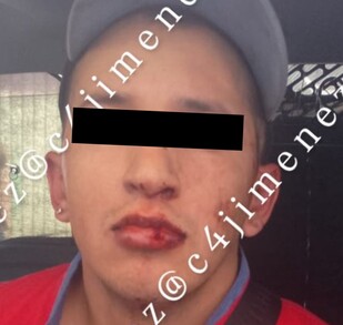 El hombre que mató a su vecino y sus perros en La Magdalena Contreras fue puesto a disposición del agente del Ministerio Público.