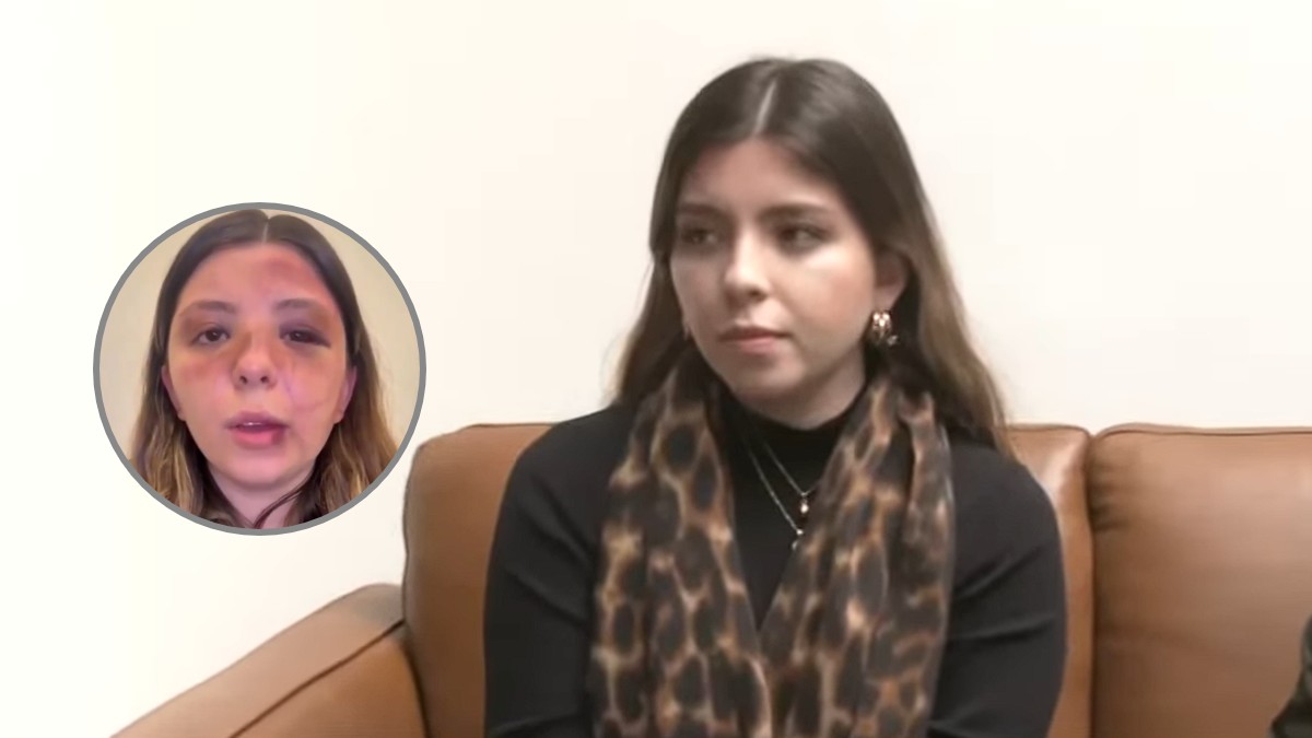 Caterina denuncia a su expareja, quien la golpeó brutalmente en su departamento de CdMx.