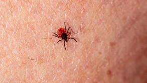 IMSS alerta por contagios de Rickettsia y emite recomendaciones.