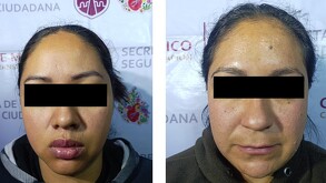 Detienen a Mariana y Dulce, integrantes de 'Los Richies', por extorsiones en Tláhuac e Iztapalapa.