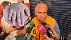 Secretario de salud Jalisco, Héctor Raúl Pérez Gómez, rodeado por micrófonos y periodistas frente a una cortina metálica negra