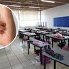 Salón de clases con mesas, mochilas, útiles escolares y pizarrones sin alumnos presentes. A la izquierda una imagen de una persona con sarampión