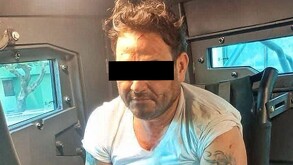 Botox vinculado a proceso