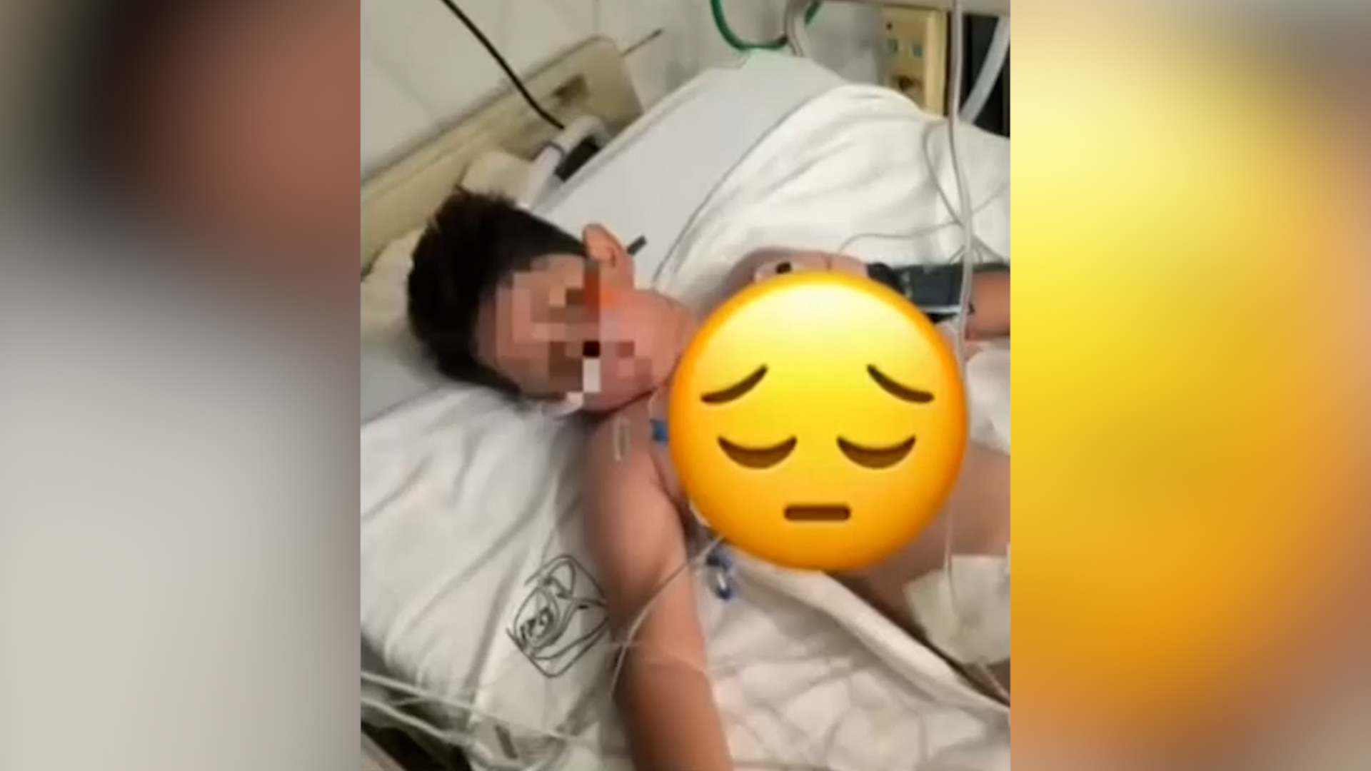 Tras 8 cirugías, Emiliano enfrenta el 'dolor fantasma' y una rehabilitación compleja.