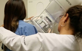 Aspectos de una prueba de mastografía