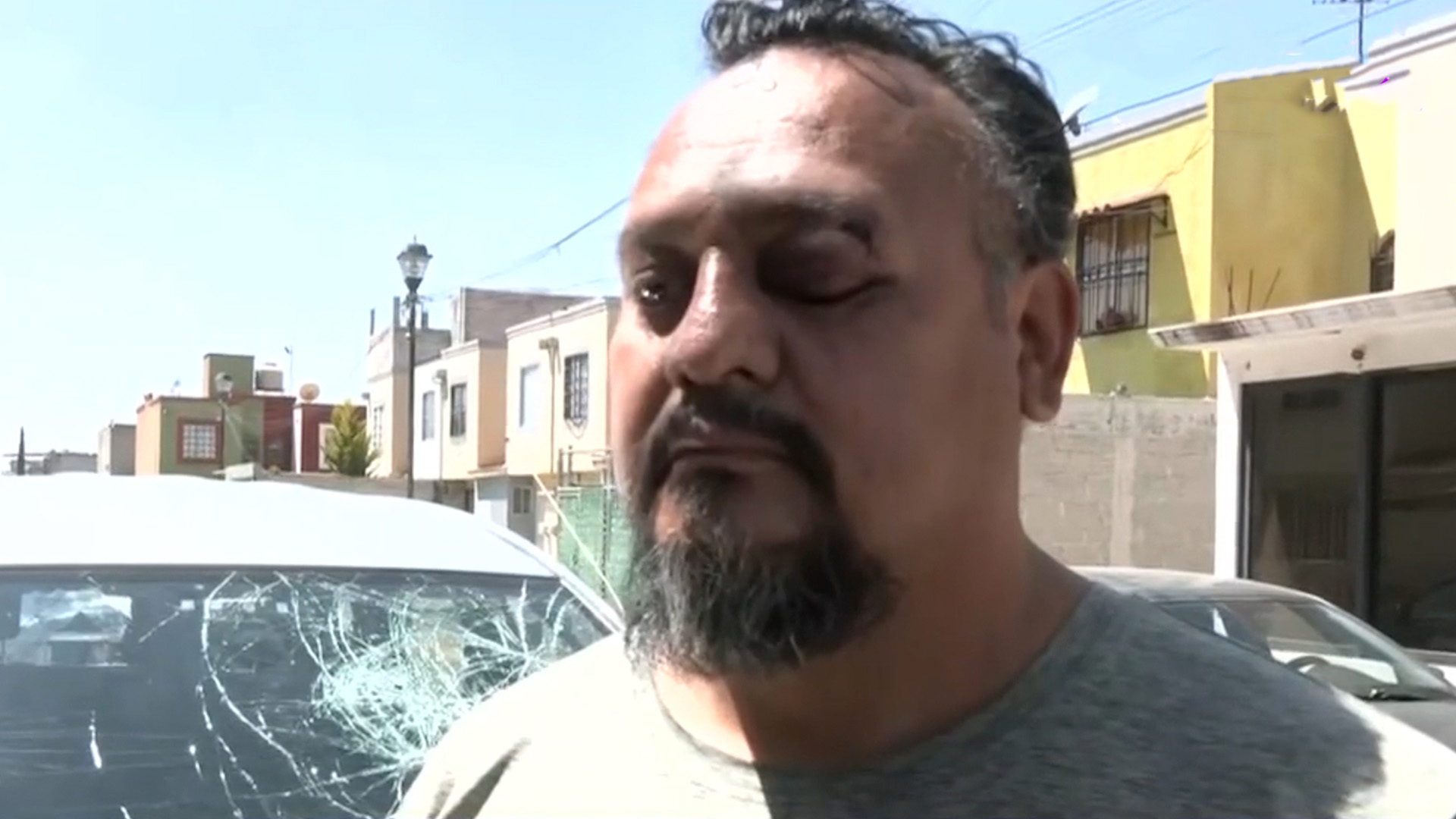 Daniel fue emboscado por 20 choferes de Uber en el Edomex. Pese a las heridas y el robo, el MP sugirió no denunciar.