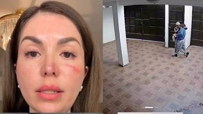 Se muestra el rostro de la víctima y una captura del video de las cámaras de seguridad del asalto en su casa en Toluca, Estado de México.