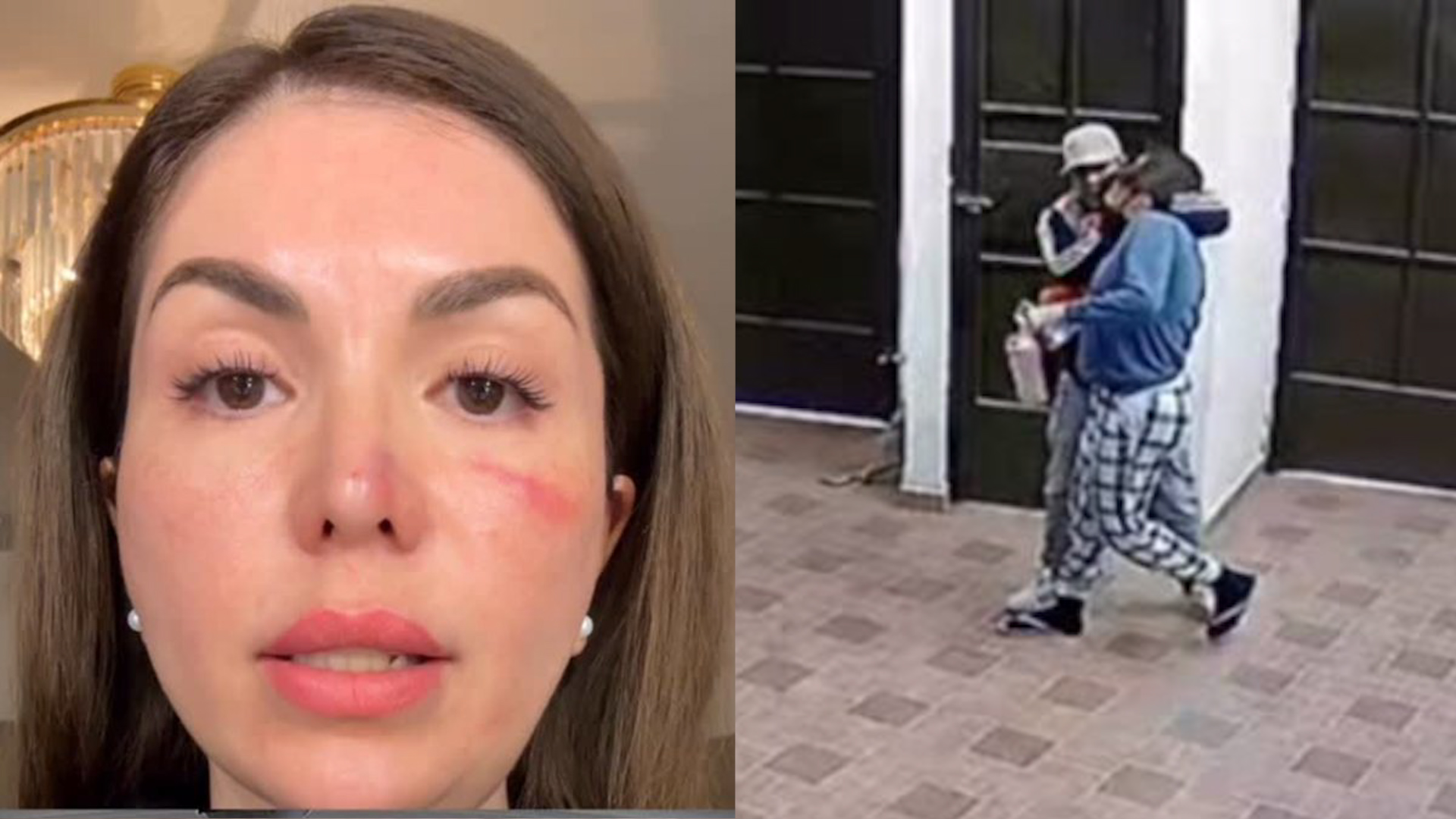 Evelyn fue atacada por cuatro hombres en su casa en Toluca. Cámaras de seguridad grabaron el robo con violencia y la agresión sufrida el 6 de marzo de 2026.