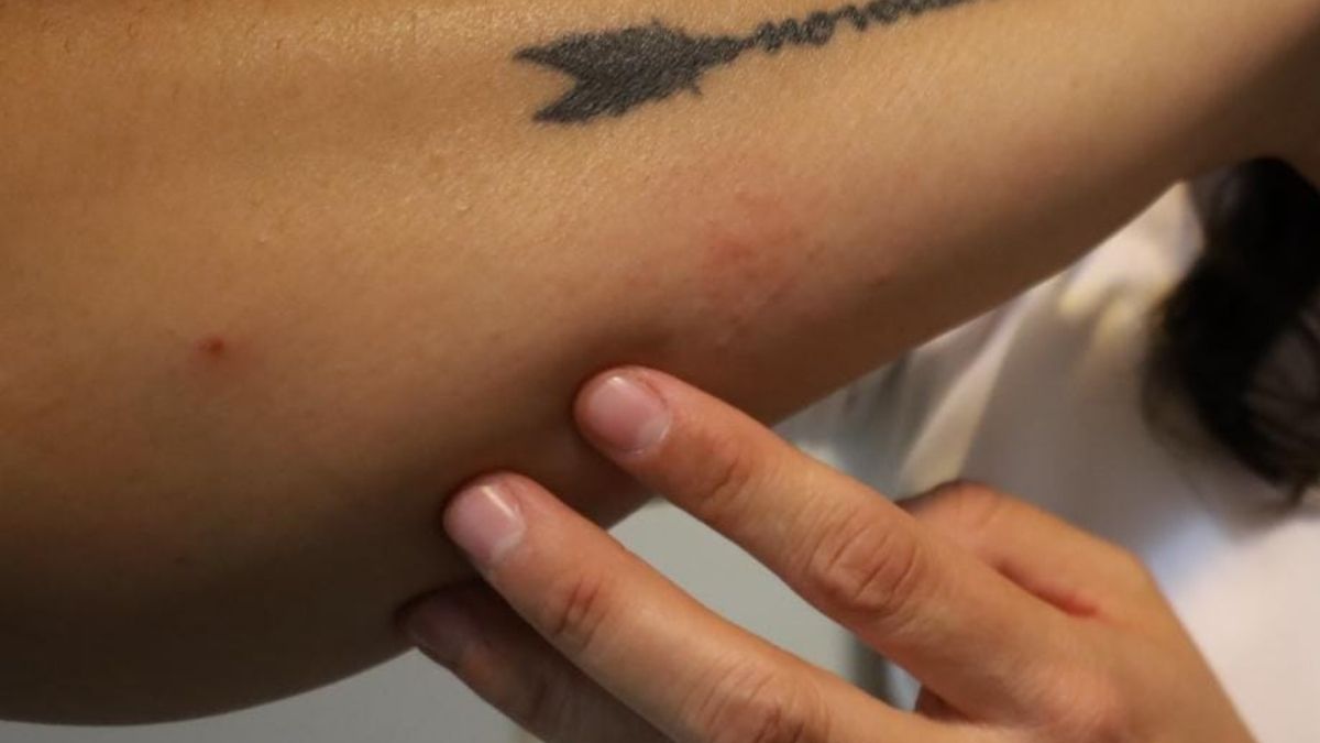 Con una gran  participación ciudadana, la Jurisdicción Sanitaria Número 6 de Torreón  llevó a cabo la brigada de detección de patologías de la piel