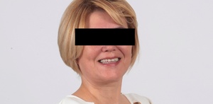 Foto de una mujer con cabello corto y rubio con una cinta negra sobre los ojos.