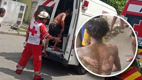 Un hombre subiendo a una ambulancia; junto, una fotografía de hombre con graves quemaduras.