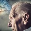 Deterioro cognitivo del Alzheimer