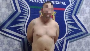 Hombre rapado sin camisa y con sobrepeso