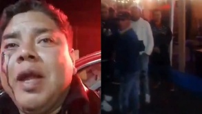 Rostro de un hombre sangrando junto a un grupo de hombres en la noche.