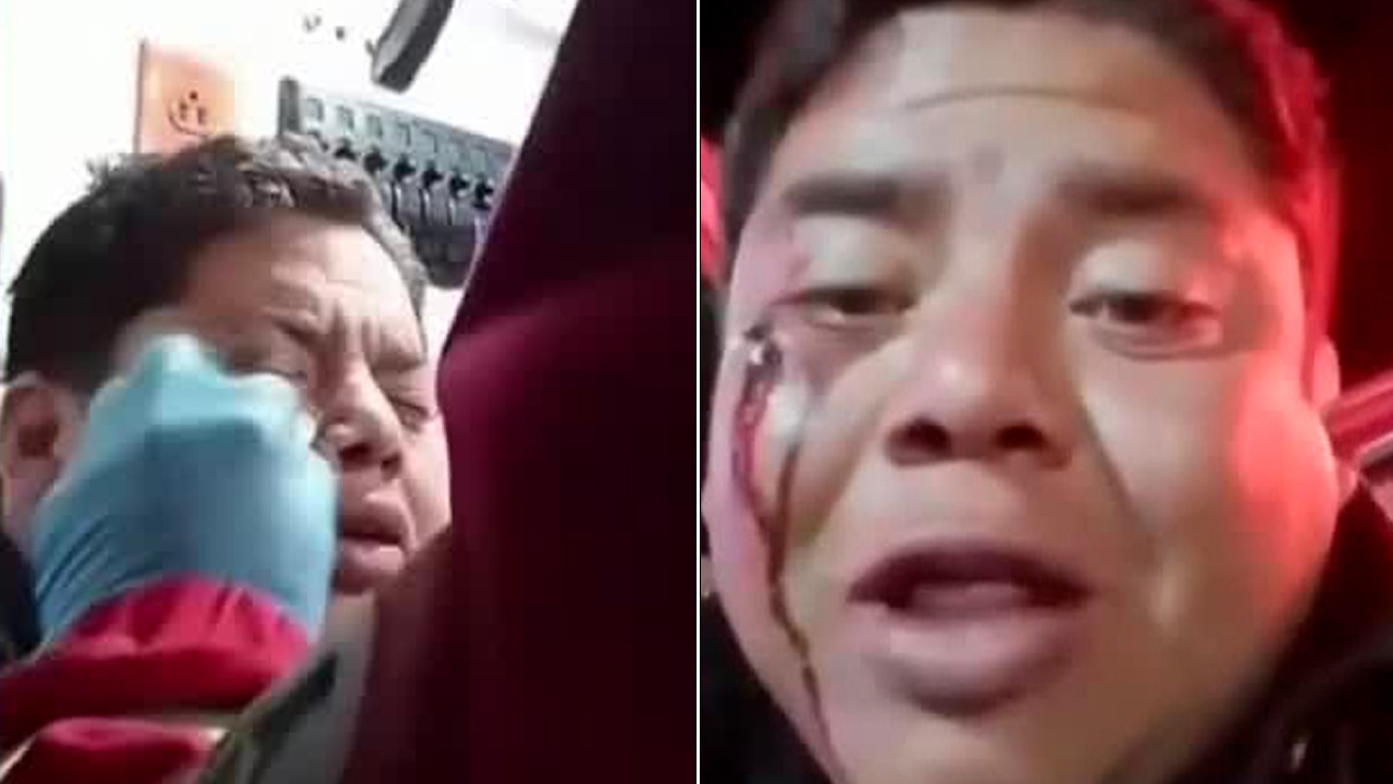 Integrantes de un grupo musical fueron agredidos en un bar de Apan, Hidalgo, tras exigir el pago de sus servicios.