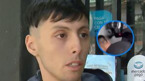 Milton, joven que vivió un calvario tras un accidente