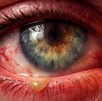 Ojo dañado por nodavirus,imagen creada por IA