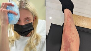 Taylor Momsen, vocalista de The Pretty Reckless y telonera de AC/DC hospitalizada en la Ciudad de México.