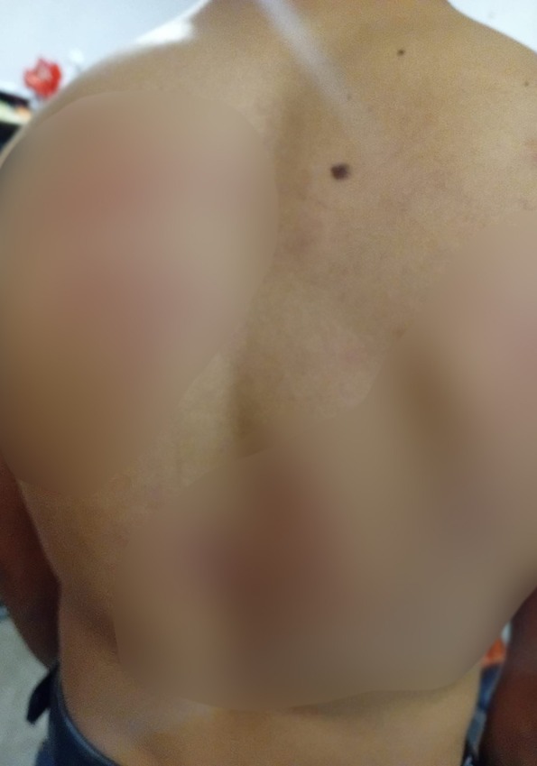 Una vecina del sector de la colonia Valencia, en Saltillo, brindó auxilio al joven, quien presentó lesiones.