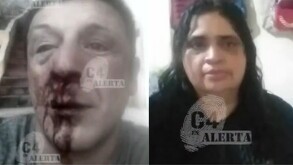 Juan Antonio y su esposa Guadalupe con golpes en la cara