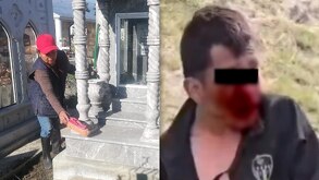 Hombre golpeado sangrando del rostro junto a la imagen de un panteón.