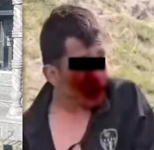 Hombre golpeado sangrando del rostro junto a la imagen de un panteón.