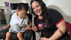 Menor con Microcefalia