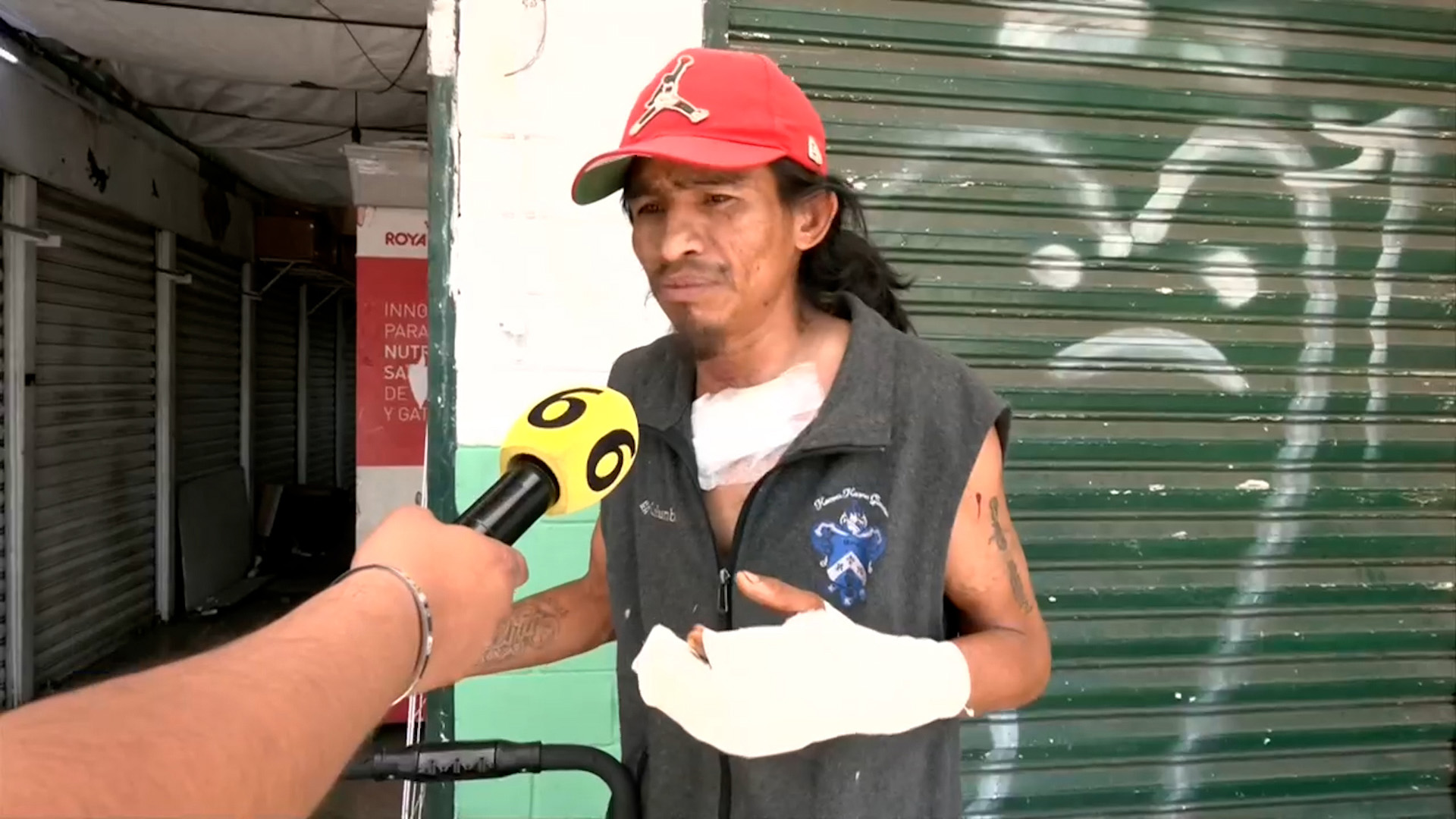 Adolfo fue apuñalado en la garganta y atacado por pitbulls en Reforma. Denuncia que el Ministerio Público de CdMx intentó culpar a su pareja por el crimen.
