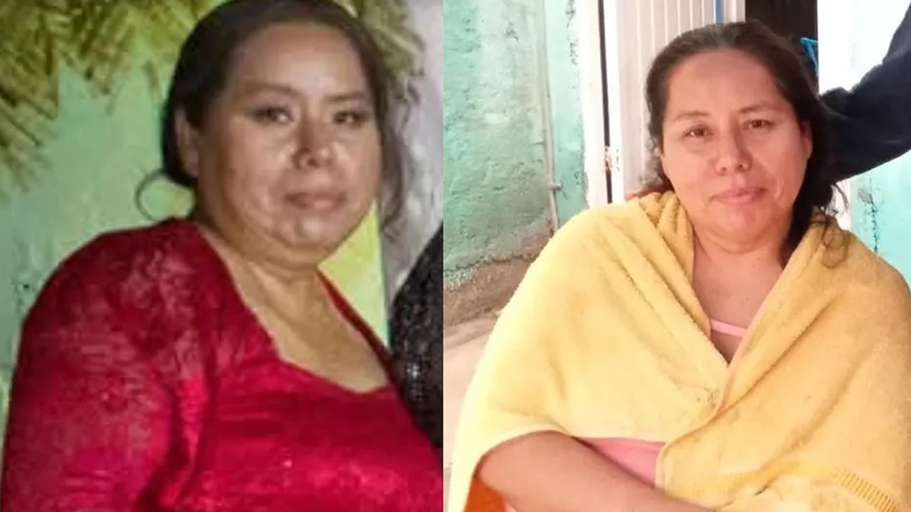 Rosa Aidé fue atacada con un machete presuntamente por su esposo en San Nicolás, tras semanas de violencia.