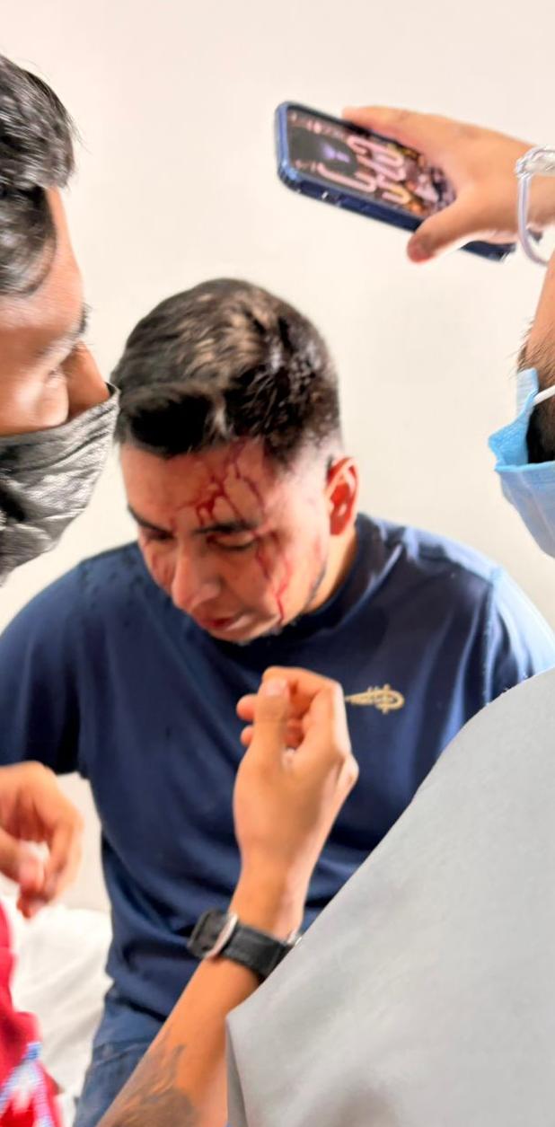 Hombre golpeado en San Pedro