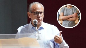 Aparece el Secretario de Salud en Jalisco, Héctor Pérez dando una conferencia de prensa y a un lado una imagen relacionada con la varicela