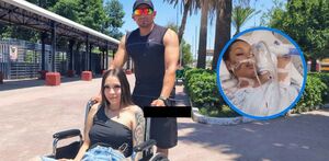 Lizeth, joven que sufrió un accidente
