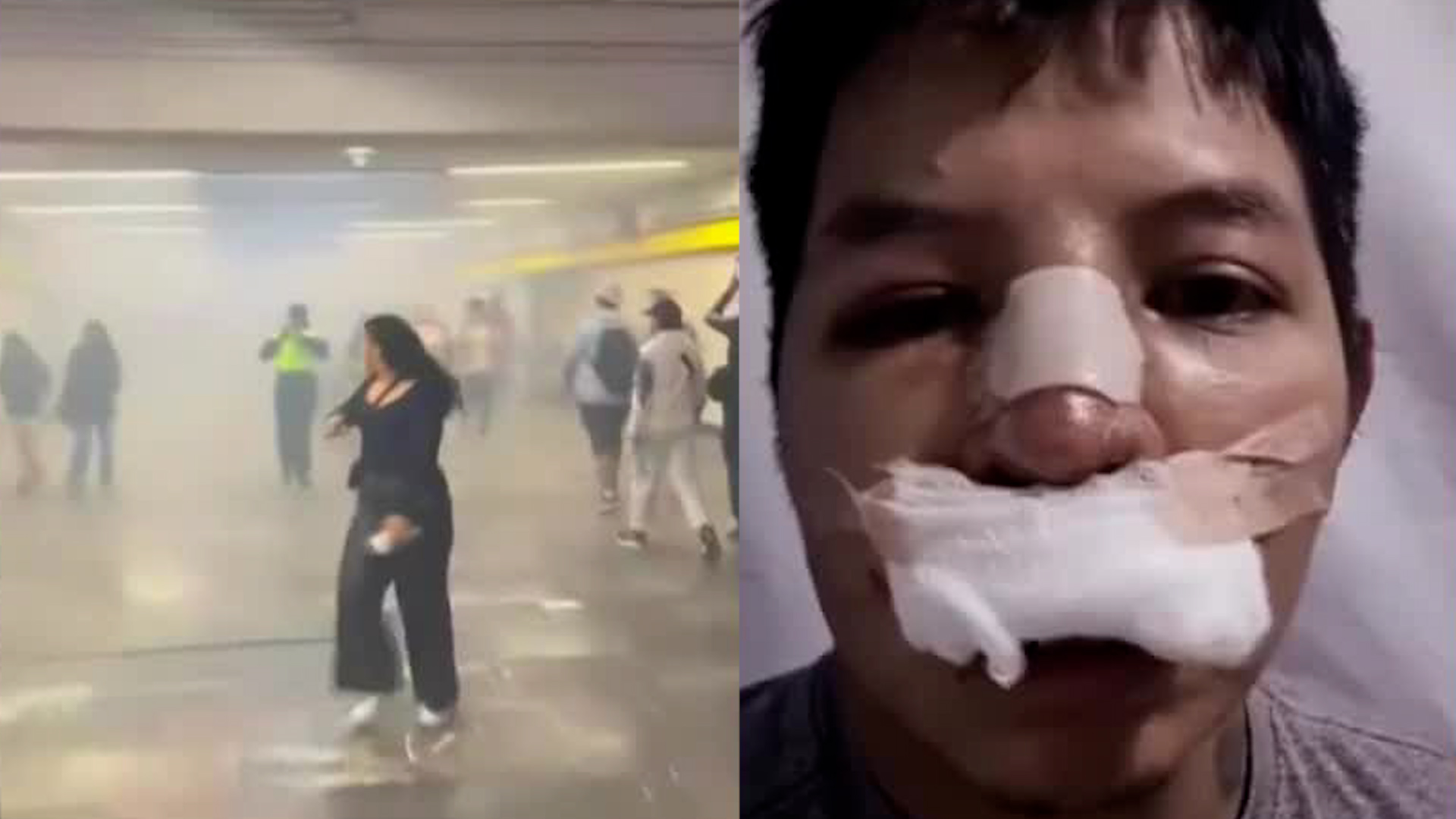 Antonio fue atacado por porros en Metro La Raza y resultó con el cráneo fracturado. Denuncia que el personal de la CdMx le negó el auxilio.