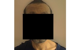 Hombre detenido luego de presuntamente haber amenazado de muerte a su madre en Torreón.