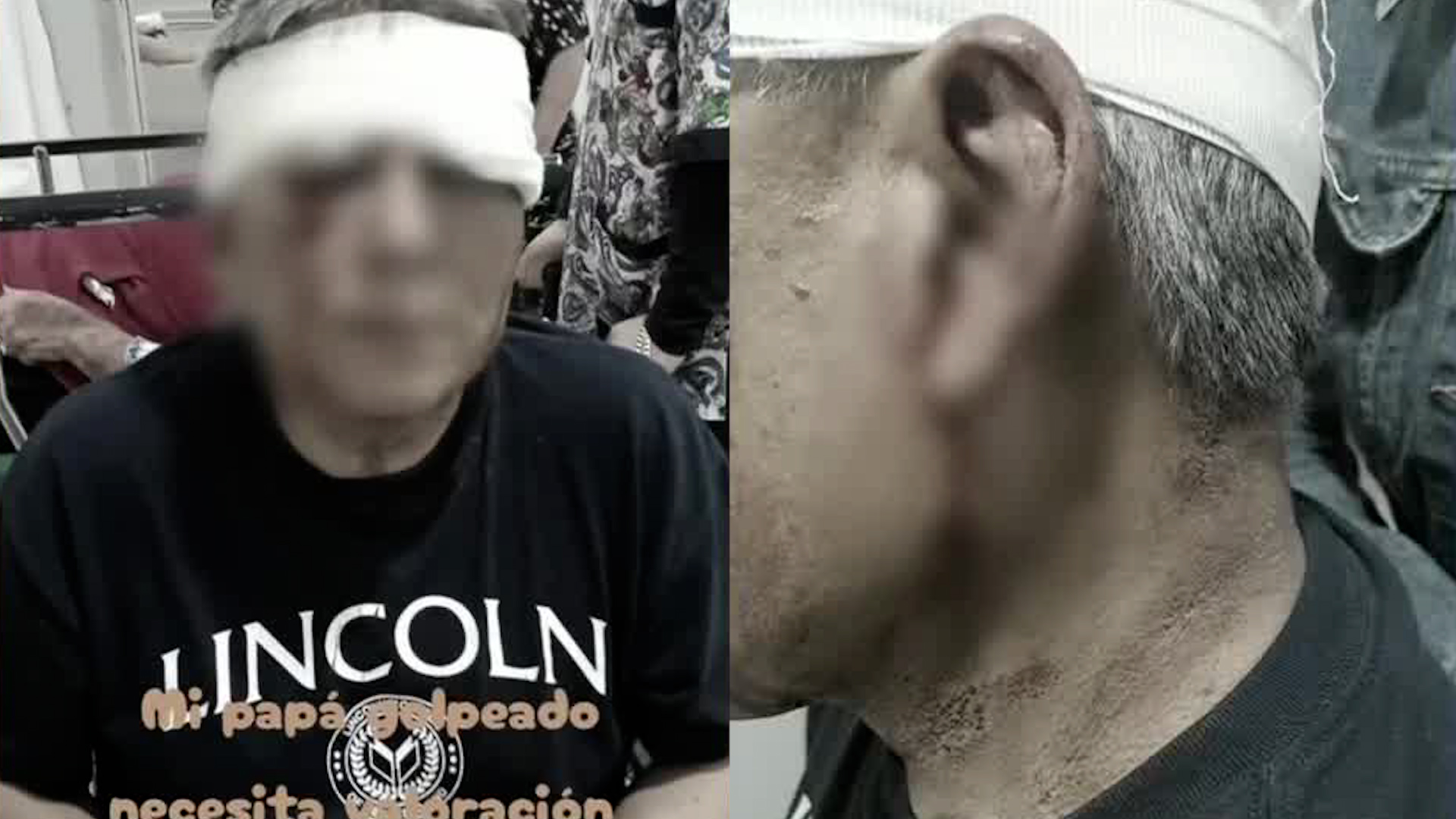 Rogelio, 55 años, agredido por vecino Christian N en Chalco. Esmeralda denuncia que autoridades investigan al padre por defenderse. Conoce detalles.