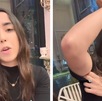una mujer muestra lesiones en su brazo tras ser detenida por la policía