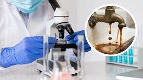 Un estudio independiente detectó falta de cloro y exceso de pH en el agua de la Americana y Villa Fontana. Vecinos reportan daños en la piel.