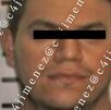Hombre atacado a balazos el barbería de Tepito