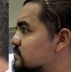Especialistas del IMSS reconstruyeron el rostro de un paciente de 29 años mediante tres cirugías de alta complejidad realizadas en la UMAE No. 21 de Nuevo León.
