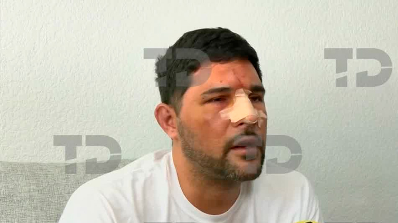 Pablo Javier Juárez, un argentino de 35 años, denunció haber sido brutalmente golpeado tras el partido España vs Argentina en el Fan Fest de la CdMx.