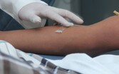 Torreón suma 92 casos registrados de hepatitis a