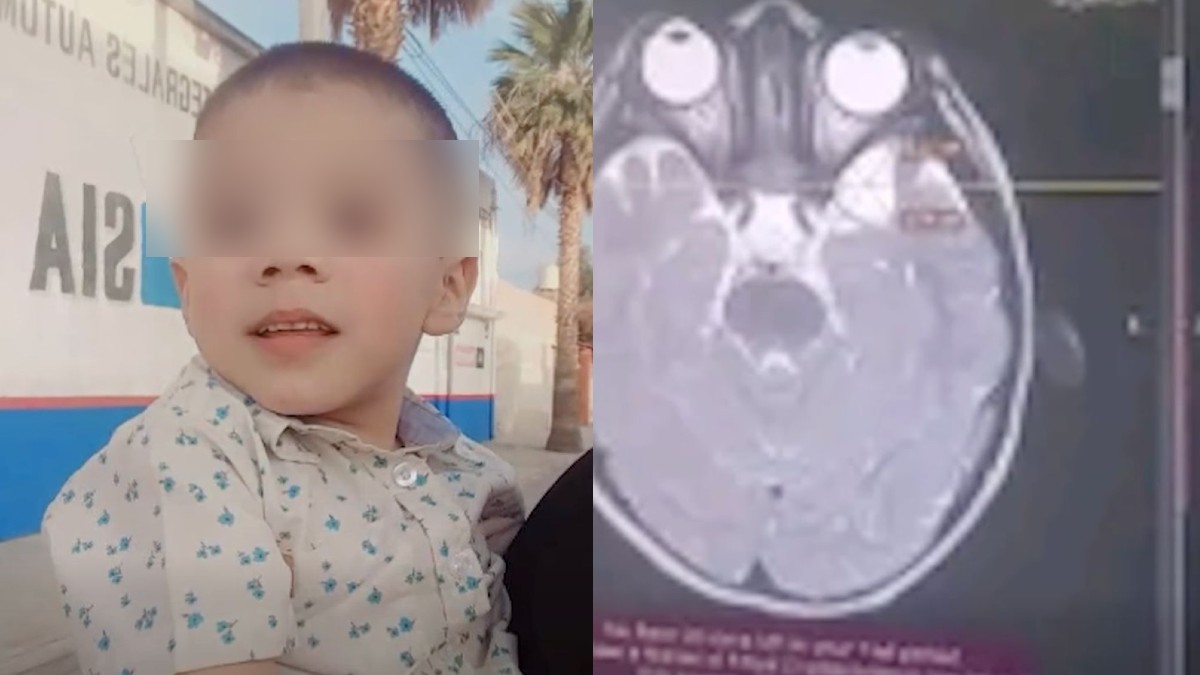 Anthony necesita seguir con su atención médica especializada y su familia solicita apoyo económico para cubrir los gastos del tratamiento.