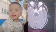 Anthony necesita seguir con su atención médica especializada y su familia solicita apoyo económico para cubrir los gastos del tratamiento.