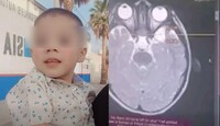 Anthony necesita seguir con su atención médica especializada y su familia solicita apoyo económico para cubrir los gastos del tratamiento.