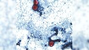Michigan registra un brote récord de Cyclospora vinculado a lechuga contaminada, con más de 3,300 casos en 2026.