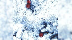 Michigan registra un brote récord de Cyclospora vinculado a lechuga contaminada, con más de 3,300 casos en 2026.