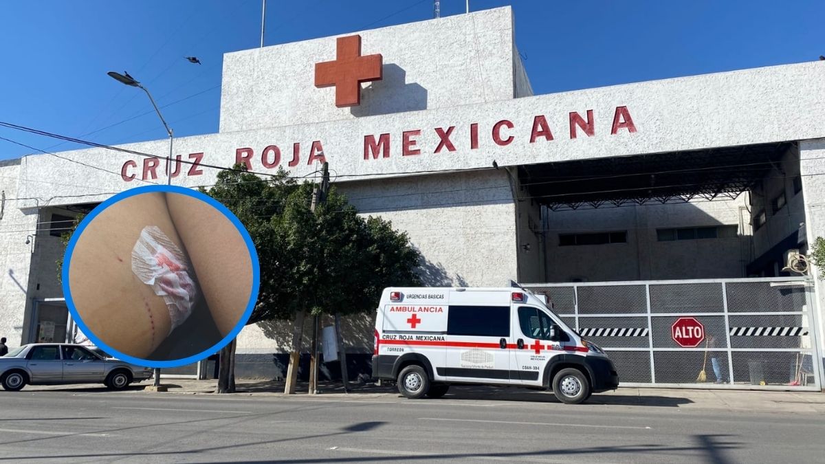 El joven resultó gravemente lesionado tras ser atacado con un arma blanca durante una presunta riña en Torreón
