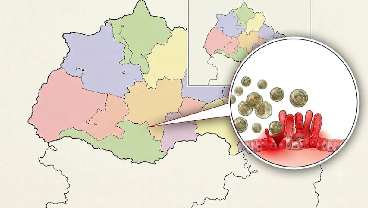 Tras un viaje al estado de Jalisco fue como derivó al contagio del virus de ciclosporiasis | Imagen generada con Gemini