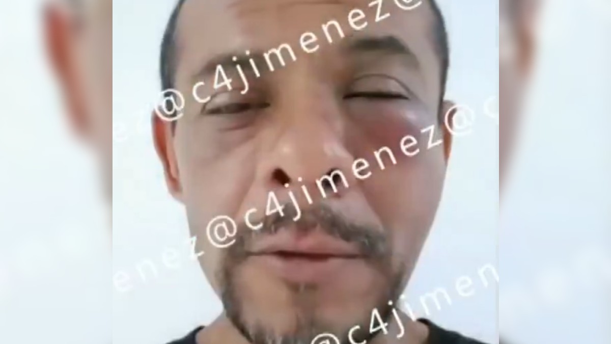 Óscar fue golpeado por sus propios primos después de que, por accidente, tomara el tapón de agua de su familia. / Carlos Jiménez
