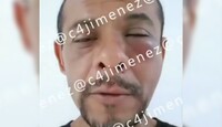 Óscar fue golpeado por sus propios primos después de que, por accidente, tomara el tapón de agua de su familia. / Carlos Jiménez